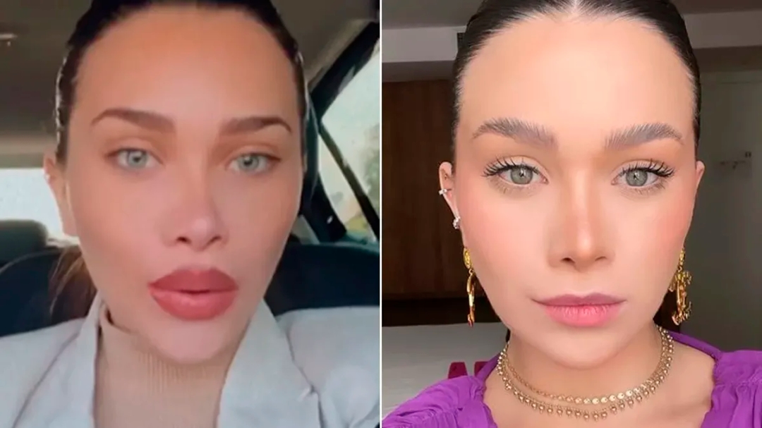 Flavia Pavanelli retira preenchimento labial e mostra resultado aos seguidores